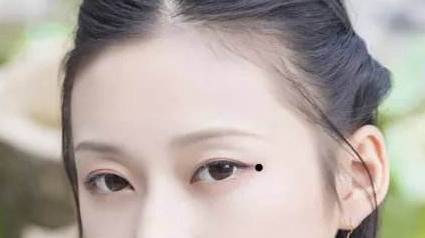 点完痣后留下红印和坑怎么办 点痣 点痣修复 美妆 第1张