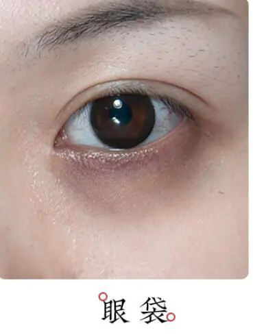 失眠睡不着长眼袋怎么办 眼袋 去眼袋 美妆 第2张