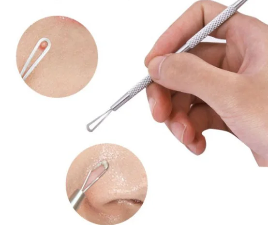 脸上的粉刺一定要挑出来吗 粉刺 挑粉刺 美妆 第2张