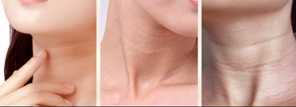 颈纹很深很难看怎么办 颈纹 颈纹解决方法 美妆 第1张