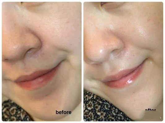 妆前保湿有做好底妆更持久 保湿 精华露 雅漾 雅诗兰黛 第2张