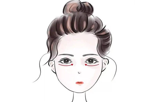 维生素E去脂肪粒步骤 维生素E 第4张