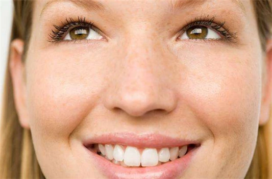 黄褐斑与晒斑的区别 黄褐斑 晒斑 第3张