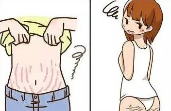 橘皮纹和肥胖纹都有什么区别 橘皮纹 肥胖纹 美妆 第2张