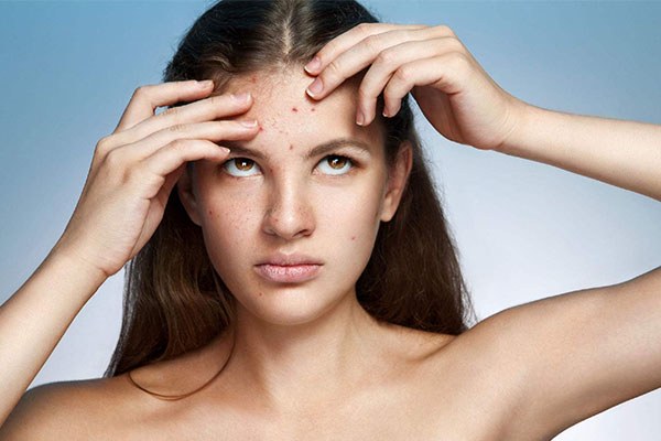 悦木之源祛痘怎么样 悦木之源 面膜 第1张