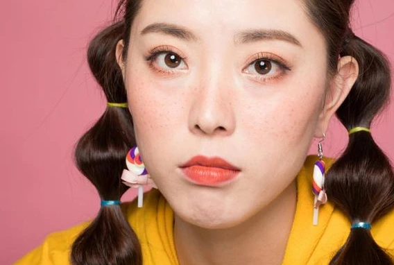 雀斑和黄褐斑的区别 雀斑 黄褐斑 第2张