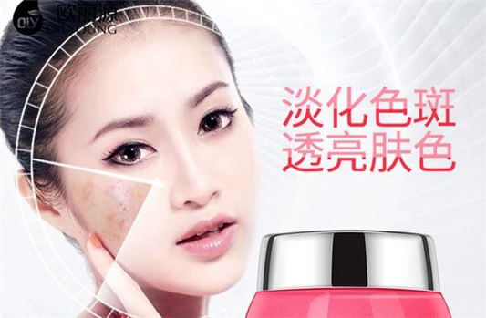 晒斑和黄褐斑的区别 晒斑 黄褐斑 第3张