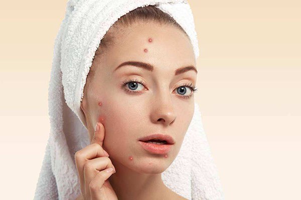 雅诗兰黛持妆粉底液会闷痘吗 雅诗兰黛 粉底液 第1张 雅诗兰黛持妆粉底液会闷痘吗 雅诗兰黛 粉底液 第1张