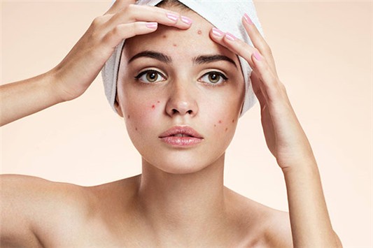 雅诗兰黛沁水粉底液会闷痘吗 雅诗兰黛 粉底液 第1张