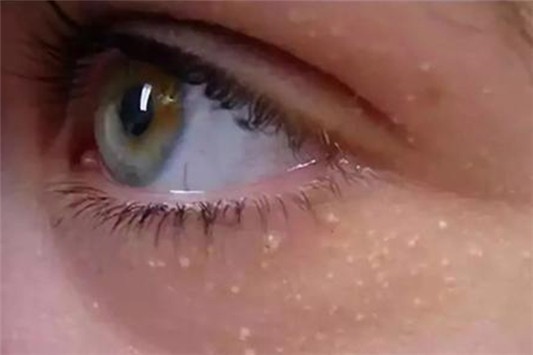 去脂肪粒的方法 眼霜 tsubu night pack 第1张