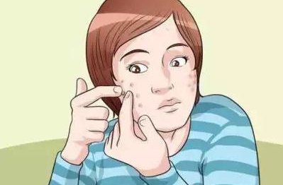 挤完粉刺可以直接敷面膜吗 敷面膜 挤完粉刺 美妆 第1张 挤完粉刺可以直接敷面膜吗 敷面膜 挤完粉刺 美妆 第1张