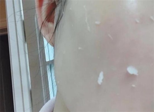 sk2前男友面膜要搓泥吗 sk2 前男友面膜 第1张