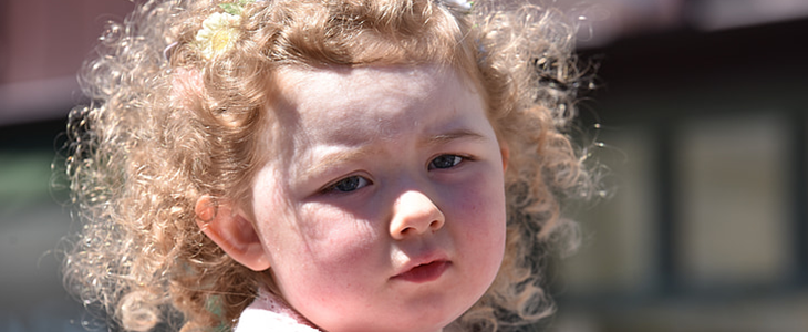 干性皮肤是什么样的 干性皮肤 美妆 第1张