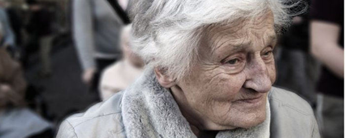 手上的老年斑怎样去掉 老年斑 美妆 第1张 手上的老年斑怎样去掉 老年斑 美妆 第1张