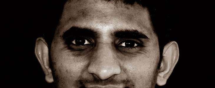 怎么样解决毛孔粗大 毛孔粗大 美妆 第3张