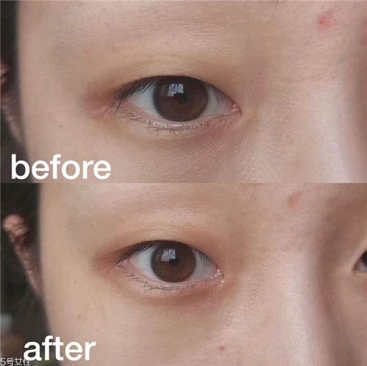 雅诗兰黛抗蓝光眼霜好用吗,对抗黑眼圈必备眼霜全面测评 雅诗兰黛 雅诗兰黛眼霜 雅诗兰黛抗蓝光眼霜好用吗 第6张 雅诗兰黛抗蓝光眼霜好用吗,对抗黑眼圈必备眼霜全面测评 雅诗兰黛 雅诗兰黛眼霜 雅诗兰黛抗蓝光眼霜好用吗 第6张