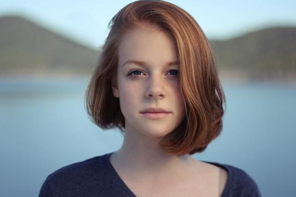 雀斑和黄褐斑的区别 雀斑 黄褐斑 第1张