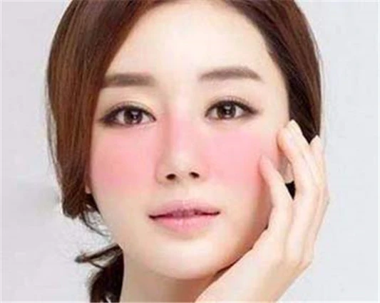 造成敏感肌肤红血丝的原因有哪些 敏感肌肤 美白祛黄 第2张