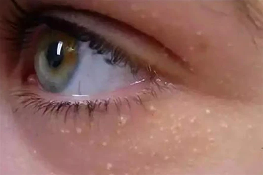 去脂肪粒最有效的眼霜 眼霜 tsubu night pack 第3张