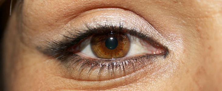 去黑眼圈小妙招 黑眼圈 美妆 第3张