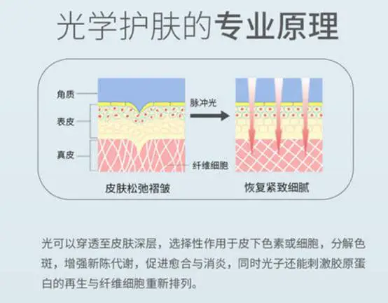 做了光子嫩肤几天见效 光子嫩肤 光子嫩肤效果 美妆 第2张