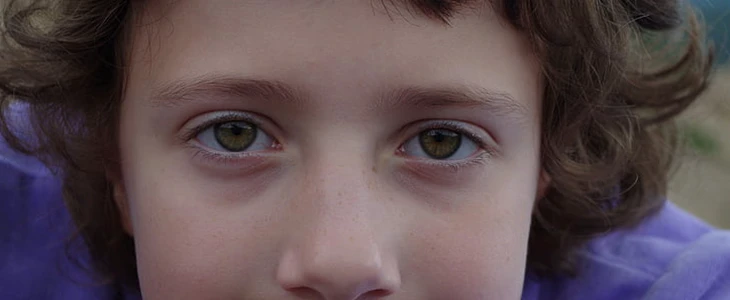 黄褐斑能自己消退吗 黄褐斑 美妆 第2张