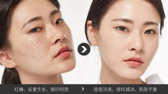 法兰琳卡芦荟胶的使用方法 芦荟胶 法兰琳卡芦荟胶 美妆 第2张