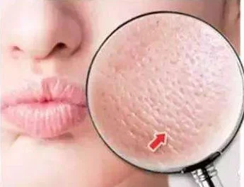 青春期最简单的收缩毛孔方法 收缩毛孔 收缩毛孔方法 美妆 第1张