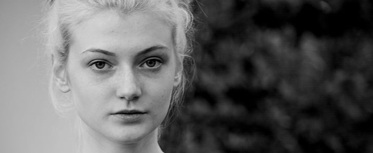 长闭口粉刺的主要原因 闭口 粉刺 美妆 第1张