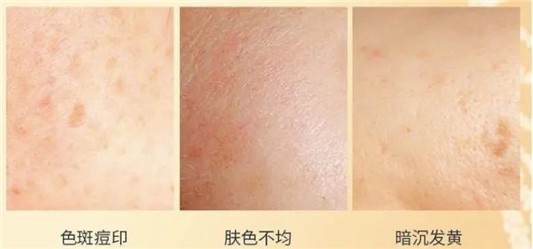 祛黄抗氧化小能手，sesderma白藜芦醇精华 sesderma 精华 第1张