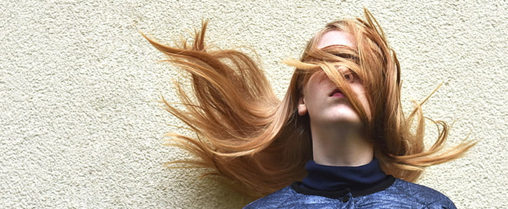 脱发严重怎么办 脱发 美妆 第1张