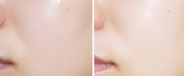 菌菇水为什么叫烂脸水 菌菇水 烂脸水 美妆 第3张