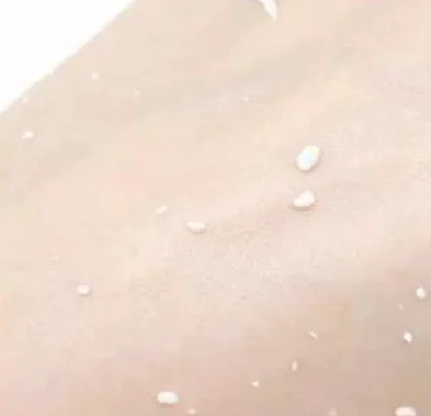 挤完粉刺痘痘可以敷面膜吗 敷面膜 挤完粉刺面膜 美妆 第3张