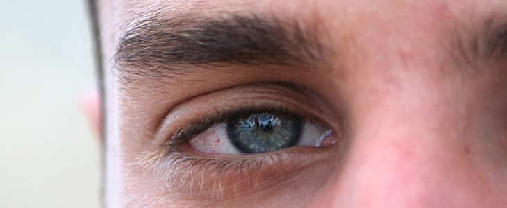 眼皮松弛怎么办 眼皮 松弛 美妆 第1张