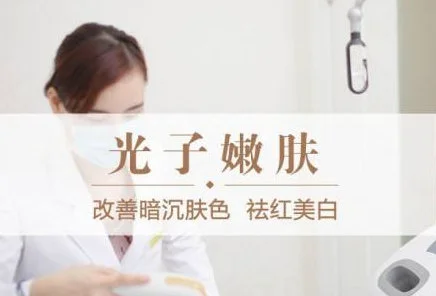 做完光子嫩肤多久可以化妆 化妆 光子嫩肤 美妆 第2张