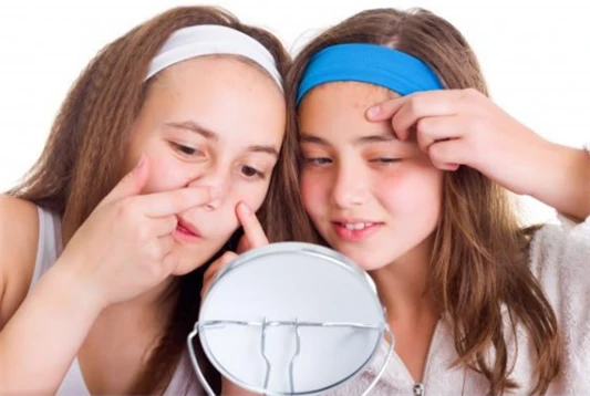 粉刺和痘痘的区别 粉刺 痘痘 第2张 粉刺和痘痘的区别 粉刺 痘痘 第2张