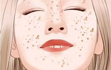 晒斑会自己消退吗 晒斑 晒斑消退 美妆 第2张