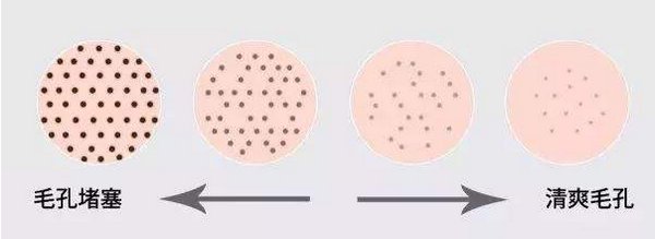 草莓鼻子怎么去掉还能缩小毛孔 草莓鼻 缩小毛孔 美妆 第1张 草莓鼻子怎么去掉还能缩小毛孔 草莓鼻 缩小毛孔 美妆 第1张