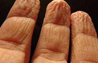 手洗了水起皱纹怎么办 皱纹 手皱纹 美妆 第1张