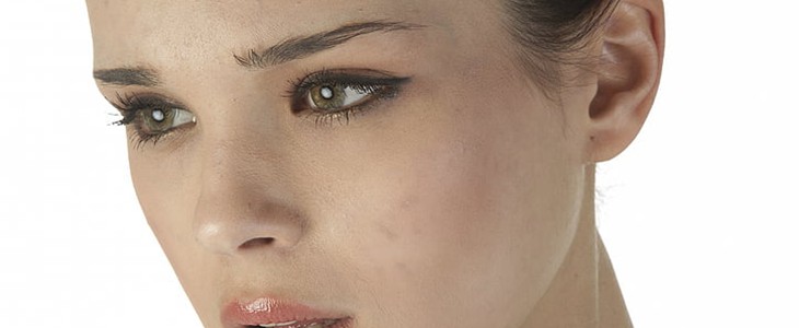 敏感性皮肤如何护理 敏感性皮肤 护理 美妆 第3张