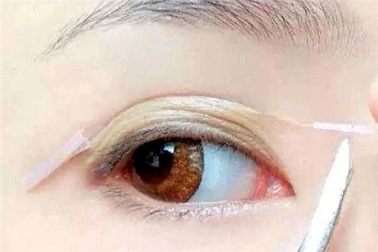 双眼皮贴怎么贴 双眼皮贴 DOG 第1张