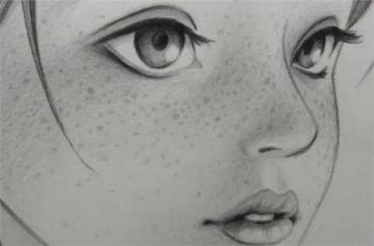 晒斑和黄褐斑的区别 晒斑 黄褐斑 第2张