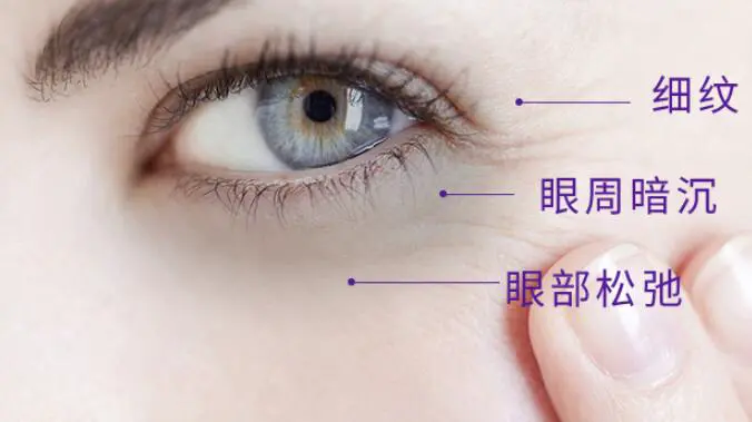 睡不着失眠导致长黑眼圈怎么办 黑眼圈 去黑眼圈 美妆 第2张