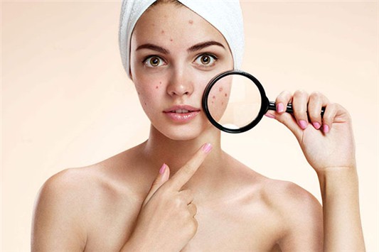 雅诗兰黛多效智妍面霜会长闭口吗 雅诗兰黛 面霜 第1张