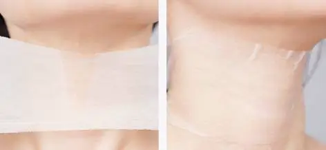 脖子敷面膜多久比较好 面膜 脖子敷面膜 美妆 第2张