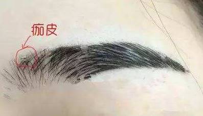 纹眉掉痂可以撕吗 纹眉 纹眉掉痂 美妆 第1张