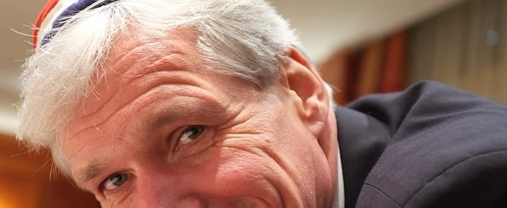 眼部细纹消除妙招 眼部细纹 美妆 第2张