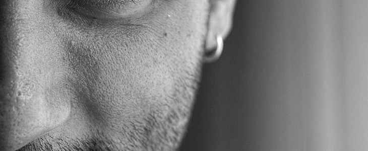 鼻子毛孔大怎么办 鼻子 毛孔大 美妆 第3张