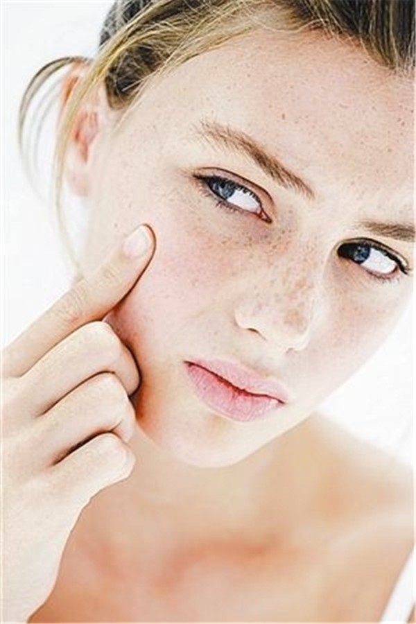 日常抗痘的方式，敷面膜易造成伤口发炎等症状 抗痘 方式 第1张