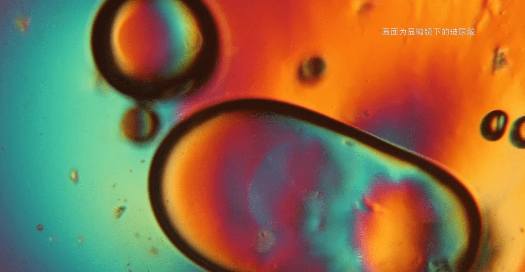 昊海生科玻尿酸打开医美市场，轻松收割美丽 昊海生科 玻尿酸 第4张